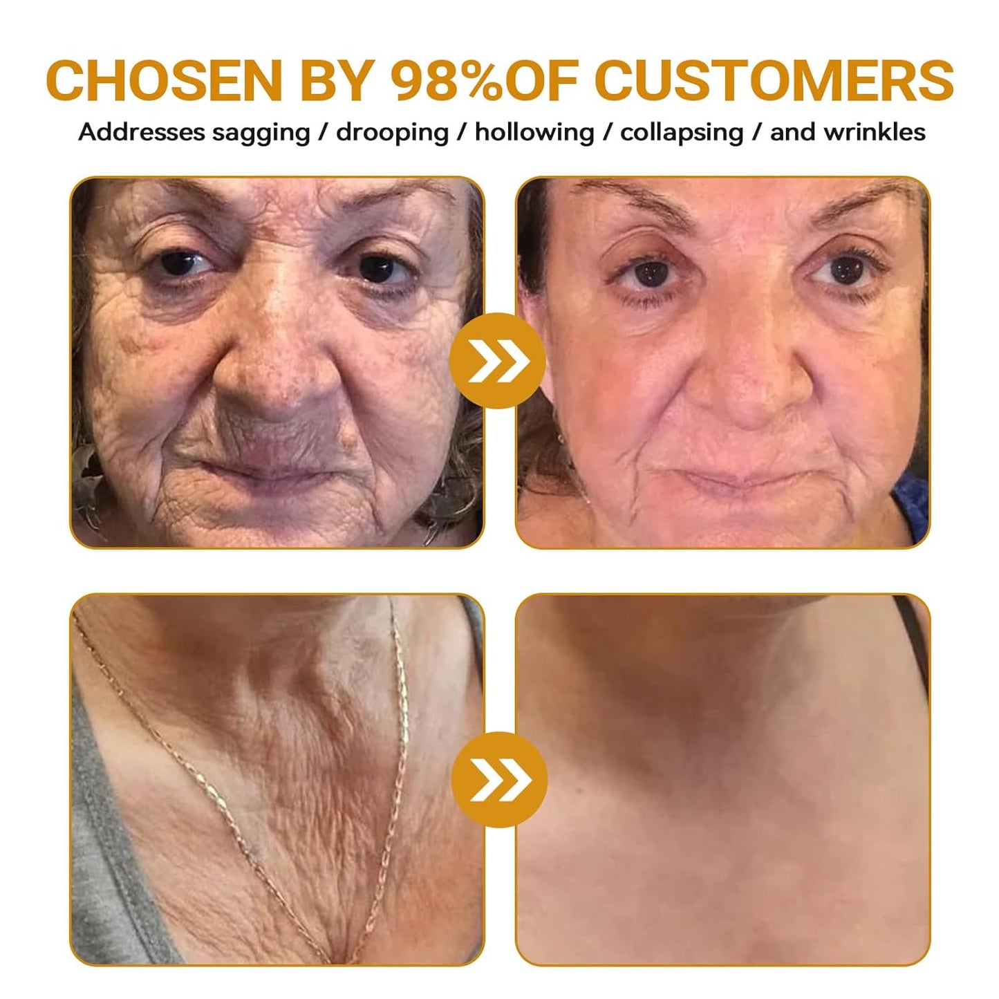 Bee VenomGlow™ Anti-Aging Cream
